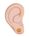 Betennelse ved hull i ørene - Hvordan få det under kontroll