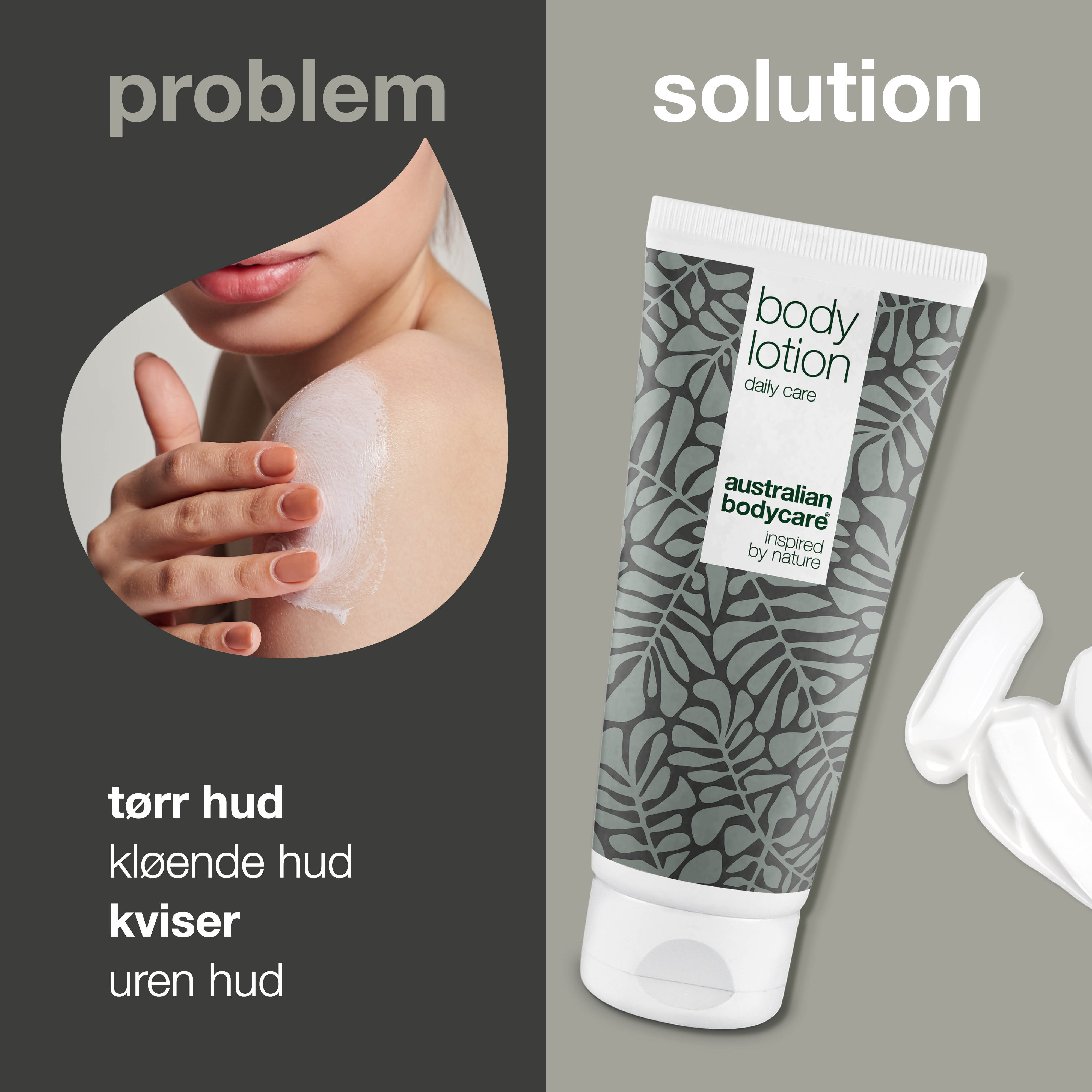 Body Lotion til tør hud og mod bumser — Fugtgivende creme til tør og uren hud på kroppen