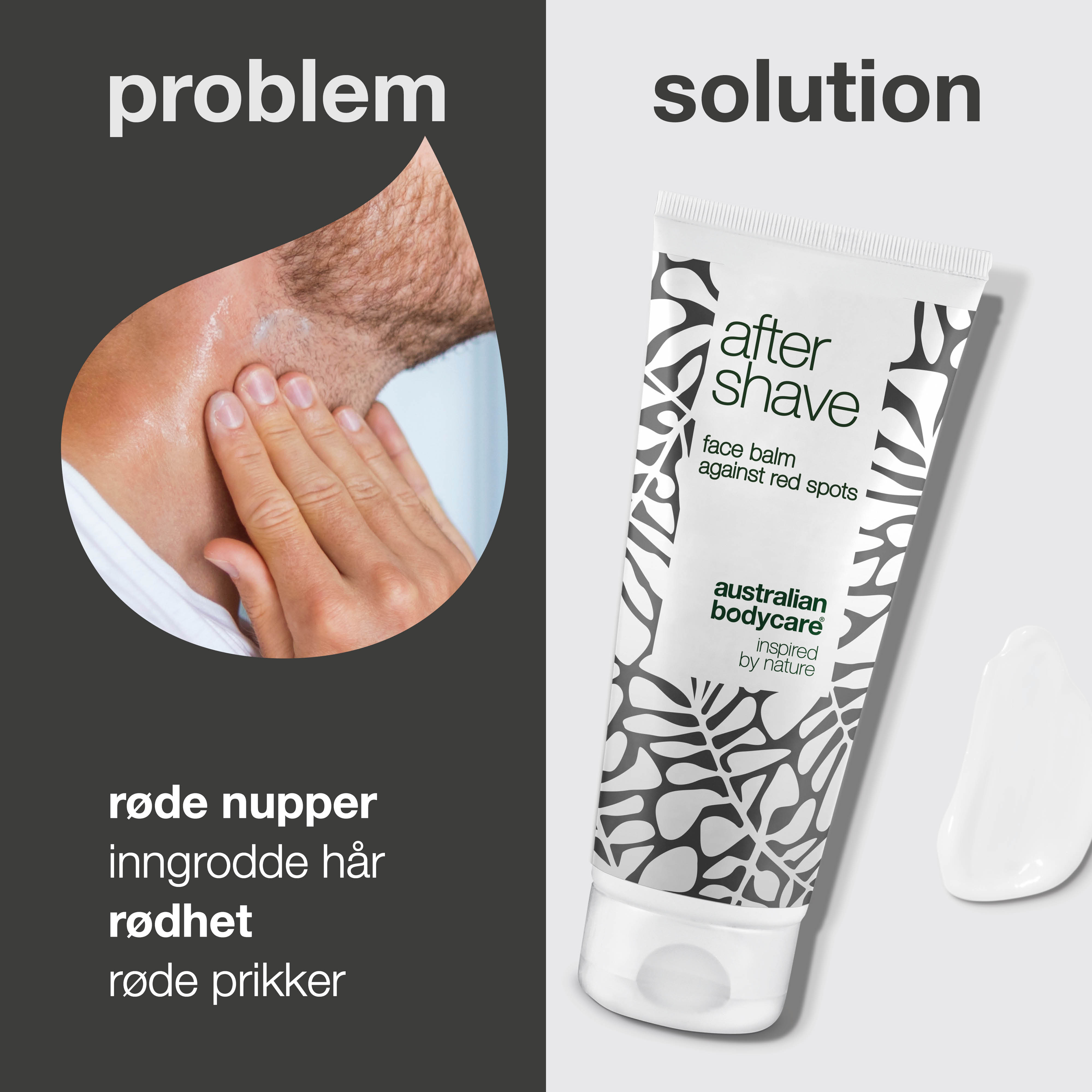 Aftershave lotion til røde barberknopper — Aftershave balm mod skægpest og indgroede hår efter barbering