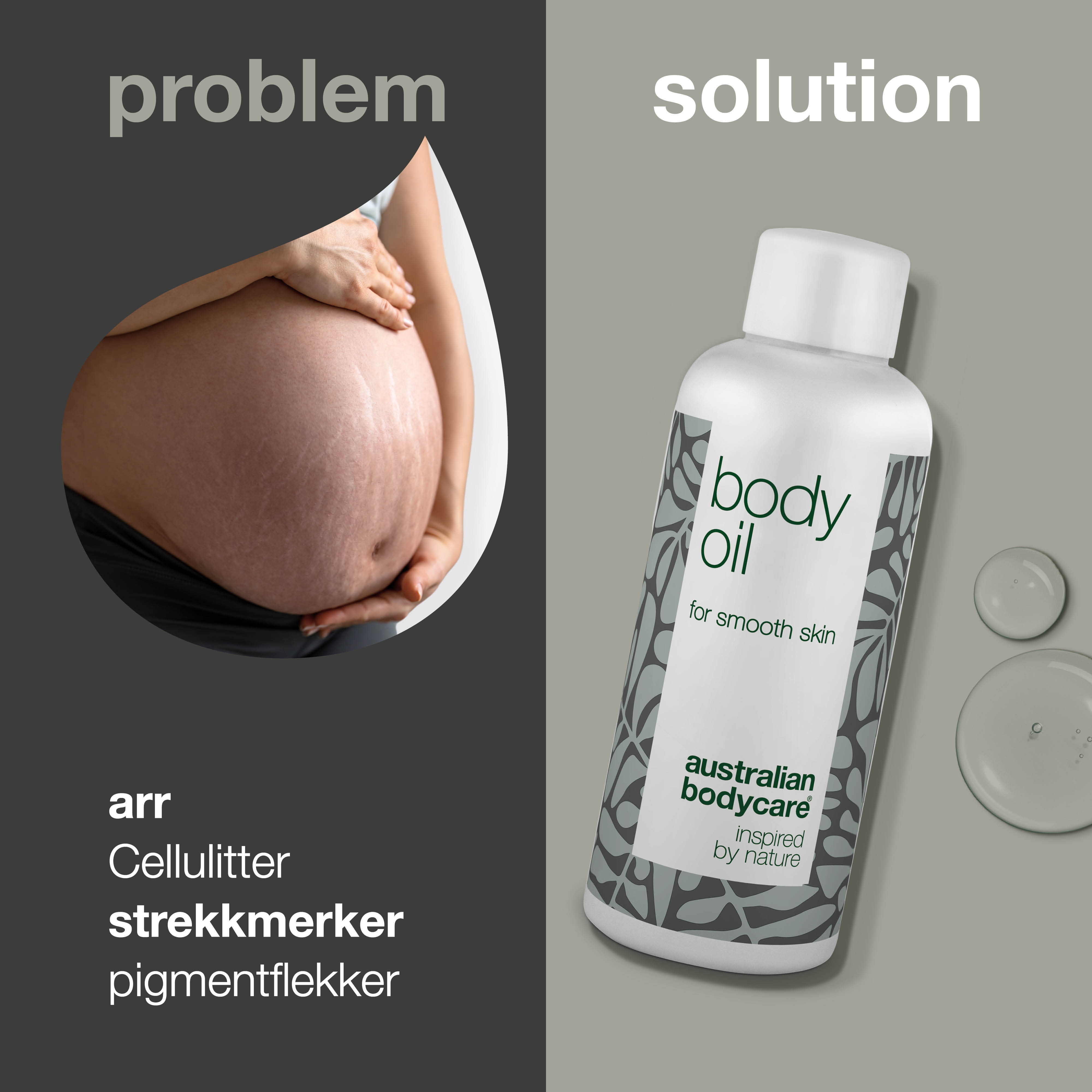 Kropsolie til pleje af strækmærker og ar — Reducerer synligheden af pigmentpletter og appelsinhud