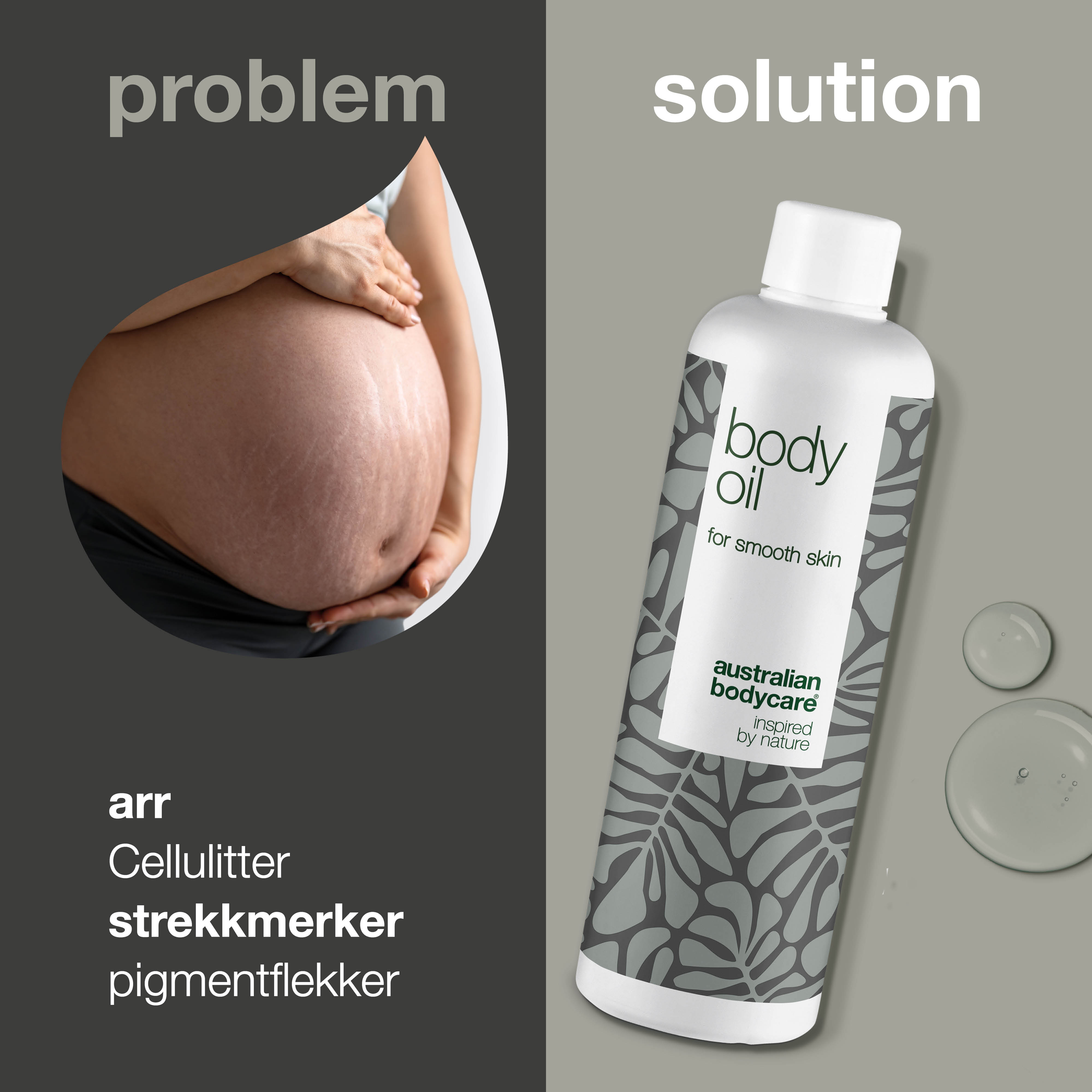 Body Oil – Reduserer strekkmerker, arr og pigmentflekker — Body Oil reduserer strekkmerker, arr og pigmentflekker. Med mandelolje, squalane og vitamin E for fuktet, myk og elastisk hud.