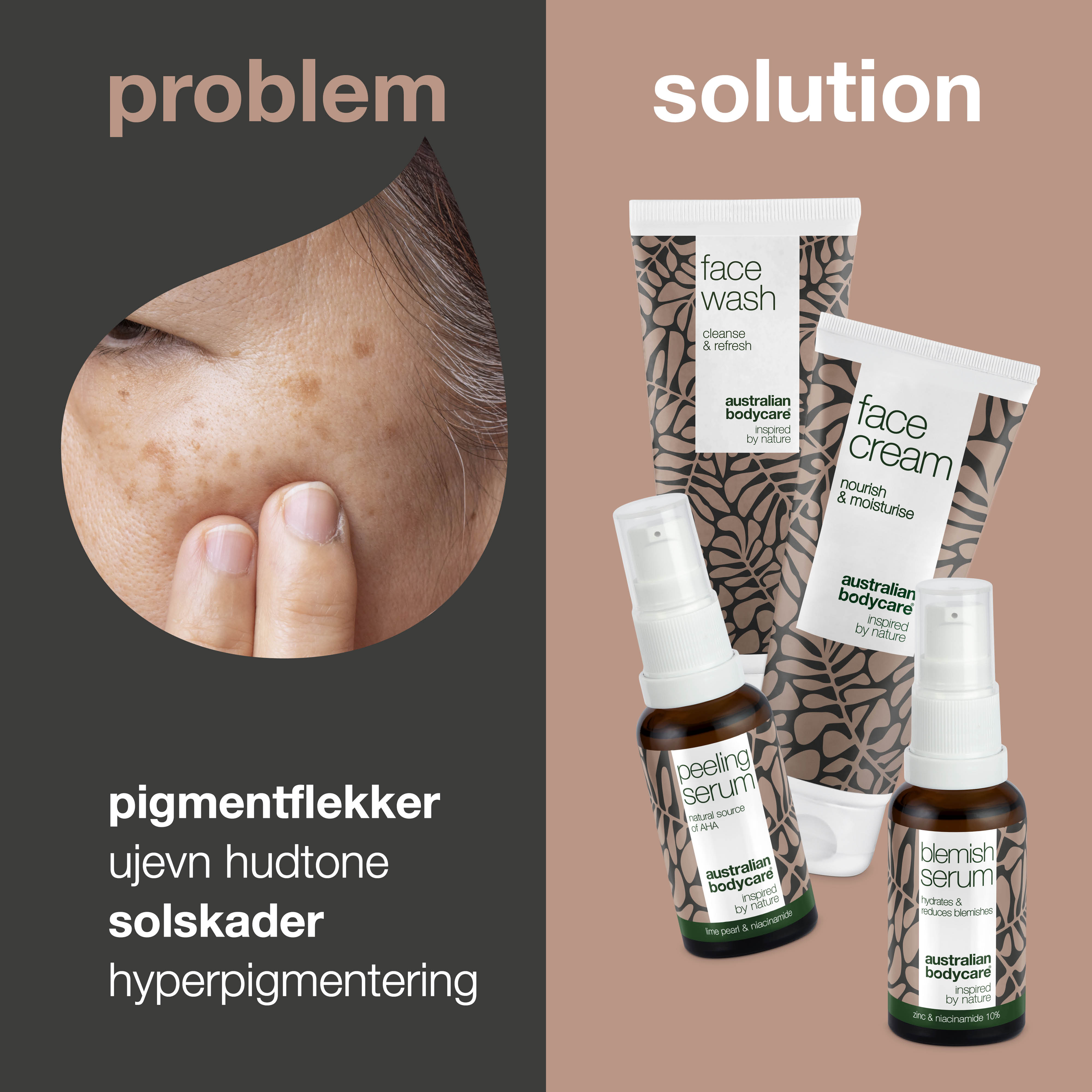 4-pak til pigmentpletter i ansigtet — Reducerer pigmentproblemer i ansigtet