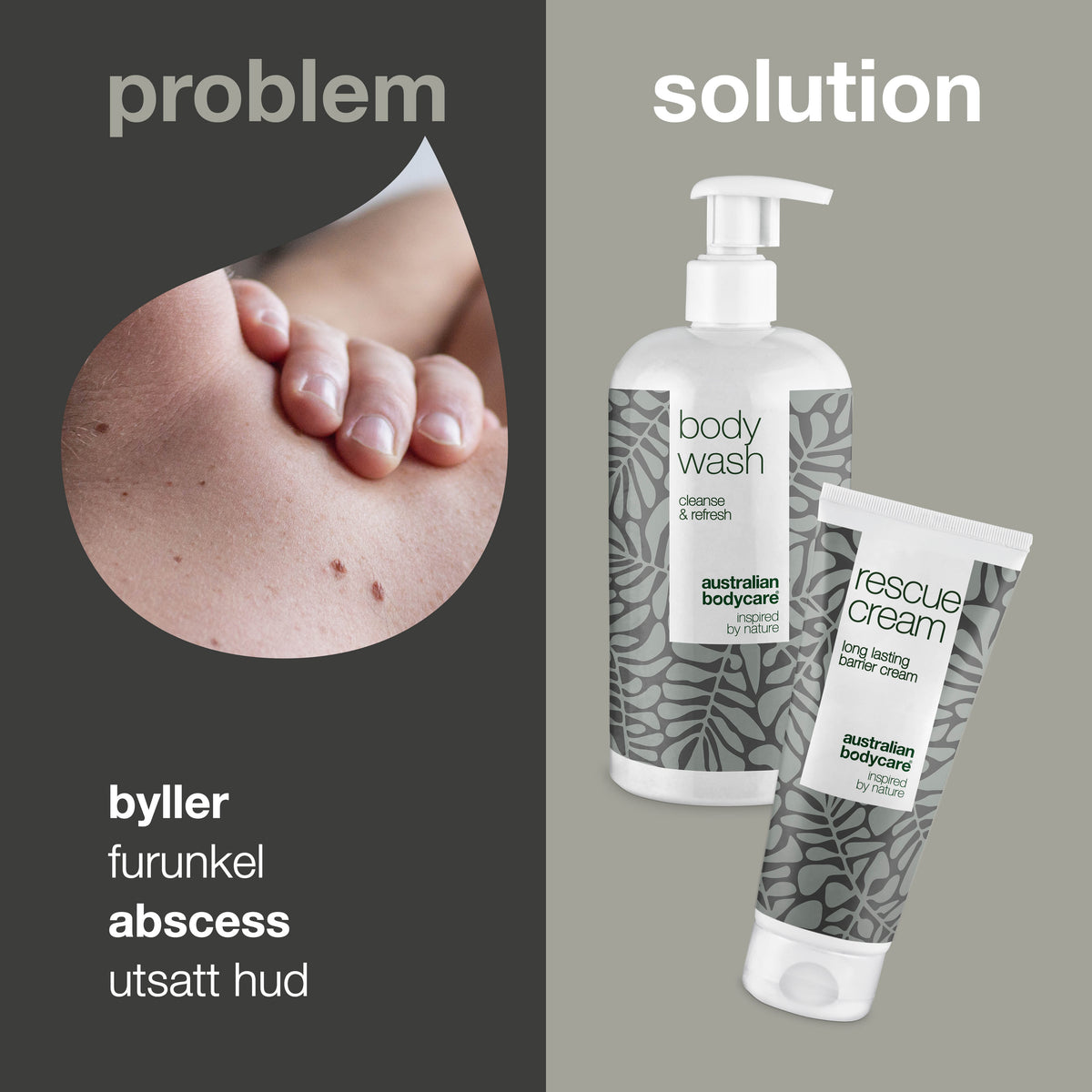 Byller Byller må behandles – Les mer om hvordan