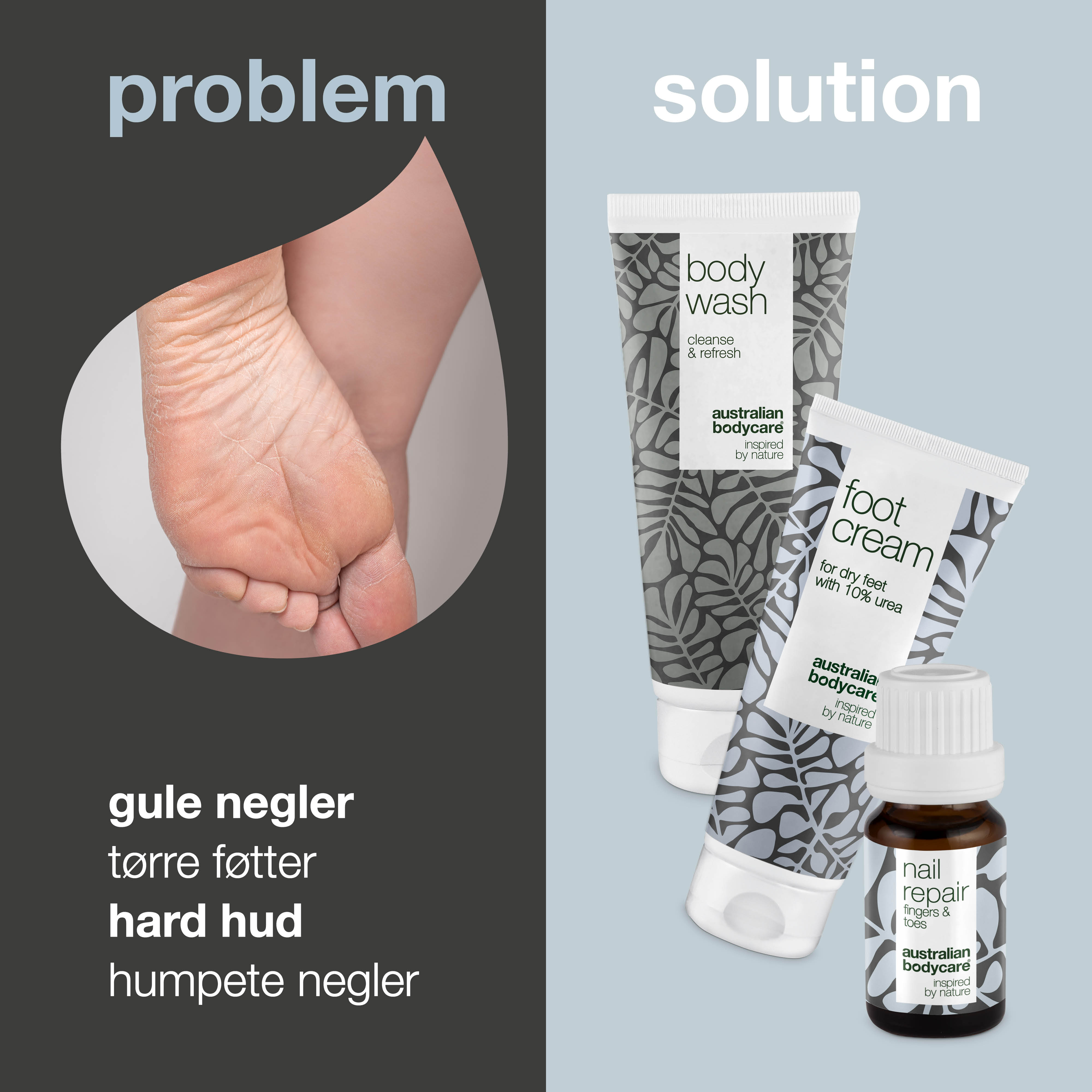 Fodplejepakke — 3 produkter til daglig pleje af tørre fødder og gule negle