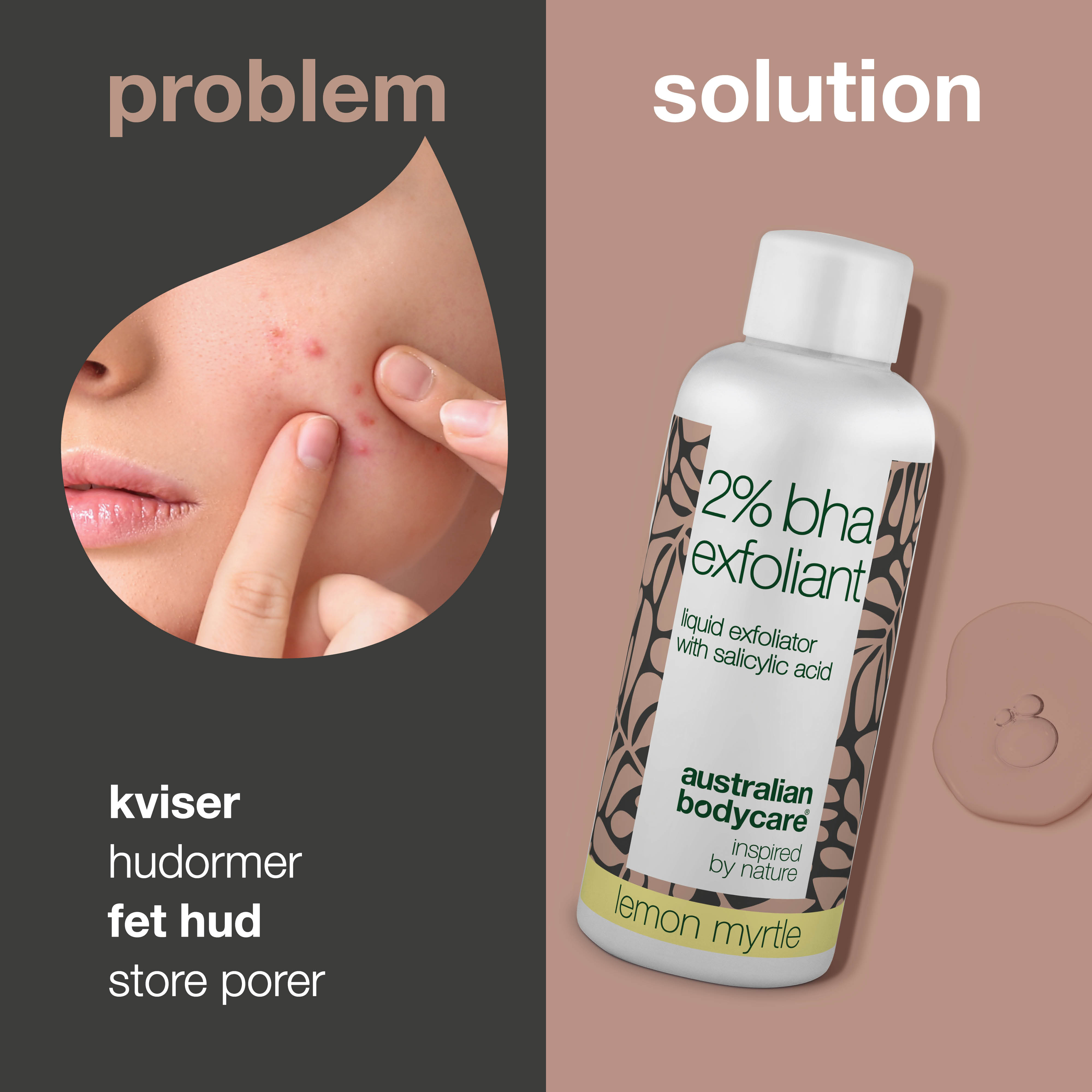 T-zone Peeling 2% BHA – Mod hudorme, bumser & fedtet hud — T-zone Peeling med 2% BHA salicylsyre reducerer bumser, hudorme og overskydende olie. Få en renere hud med færre urenheder.