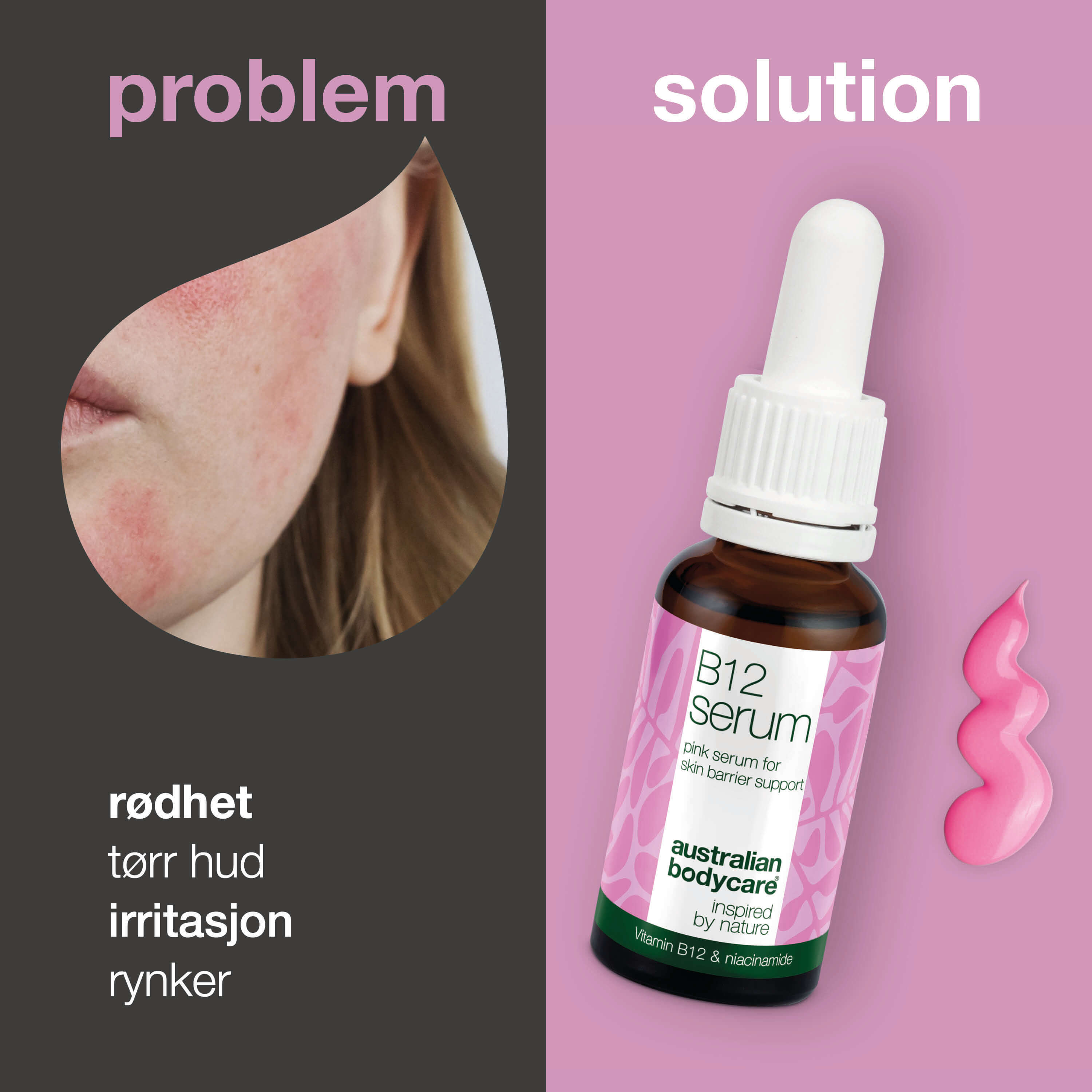 B12 Pink Serum – Reduser rødhet og styrk hudbarrieren — B12 Serum reduserer rødhet og styrker hudbarrieren. Perfekt for tørr & sensitiv hud. Opplev en sunn & strålende hud med naturlige ingredienser.