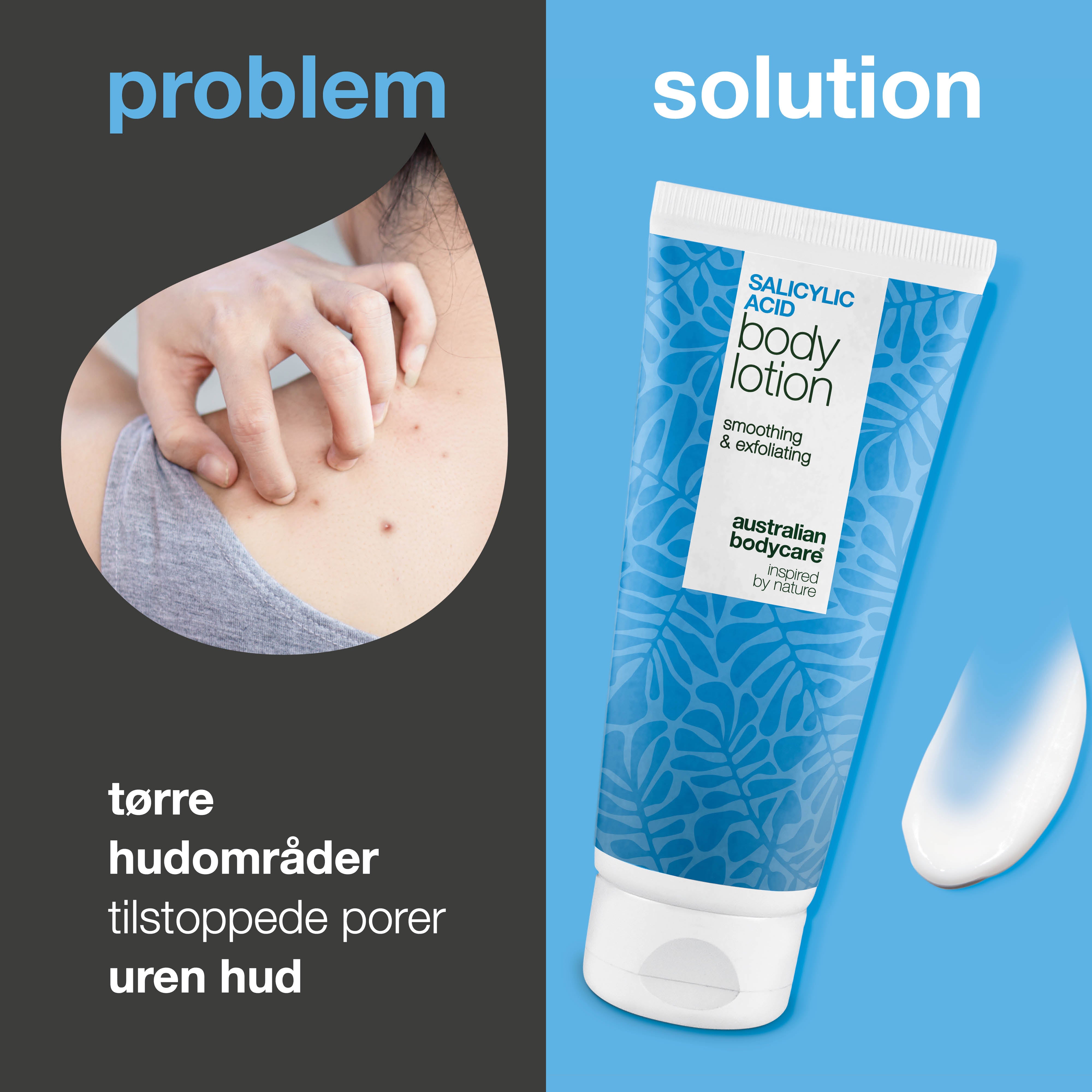 Body Lotion med salisylsyre – for tørr og ujevn hud — Body Lotion med salisylsyre eksfolierer, fukter og hjelper med å mykgjøre tørr og ujevn hud. Perfekt for daglig bruk.