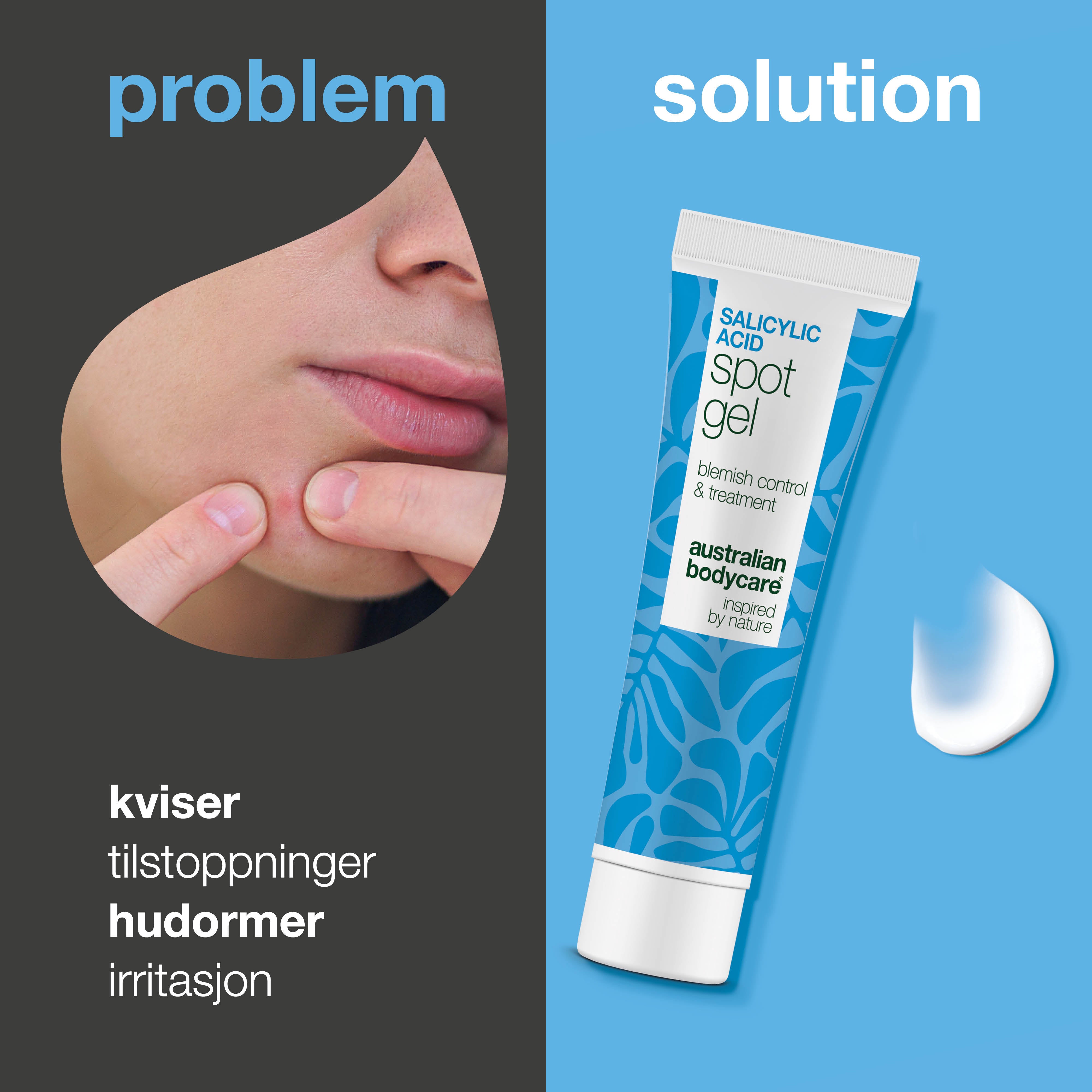 Salisylsyre Spot Gel mot kviser, hudormer og rødhet – renser porer og beroliger huden