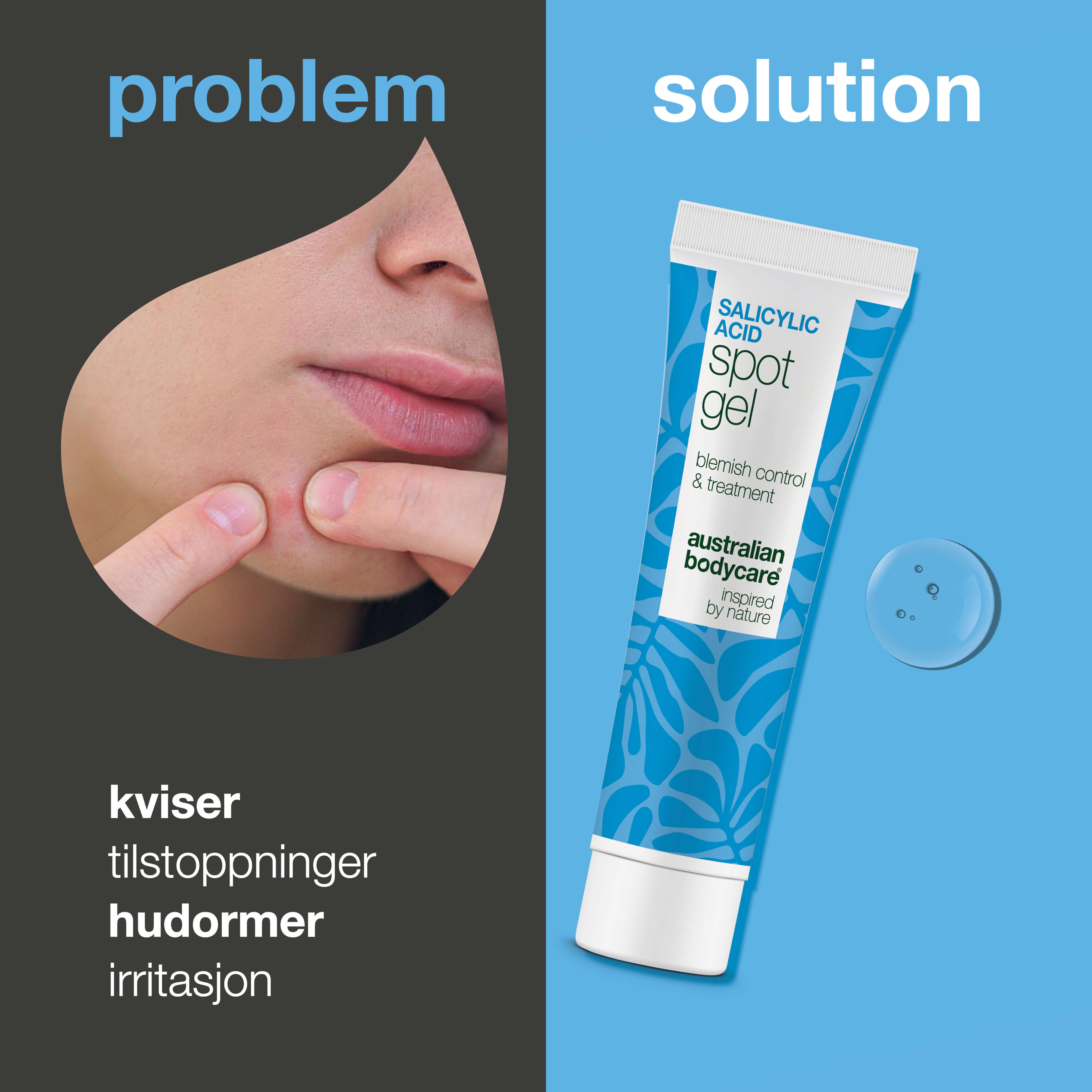 Salisylsyre Spot Gel mot kviser, hudormer og tette porer — Salisylsyre Spot Gel balanserer fet hud og fjerner døde hudceller. Effektiv pleie med salisylsyre for klarere hud.