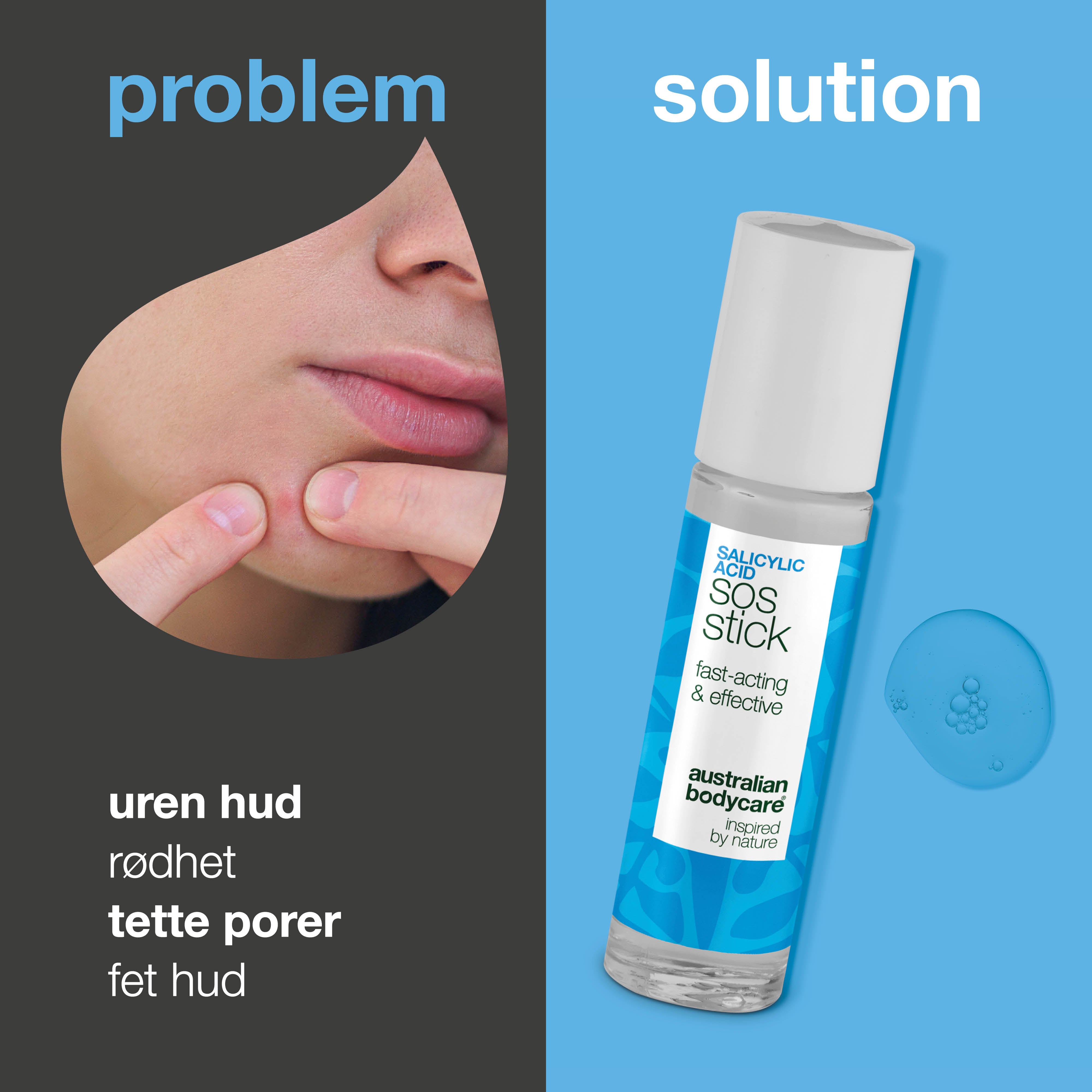 Salisylsyre SOS Stick mot kviser og rødhet – renser porene og beroliger huden raskt