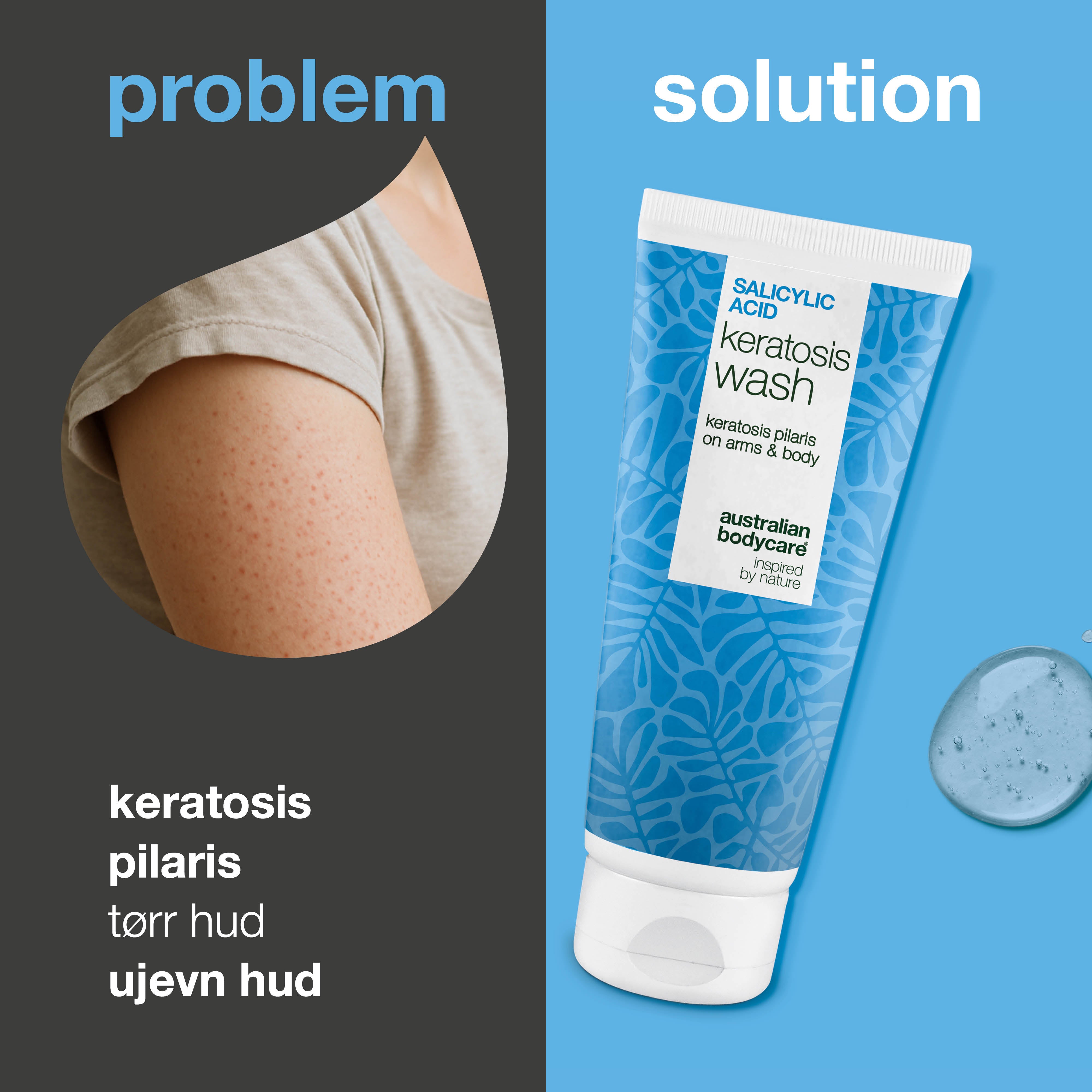 Keratosis Pilaris Body Wash mot keratosis pilaris, tørr hud og porer. Beriket med salisylsyre, niacinamid, sink PCA og vitamin E for synlig glattere hud.