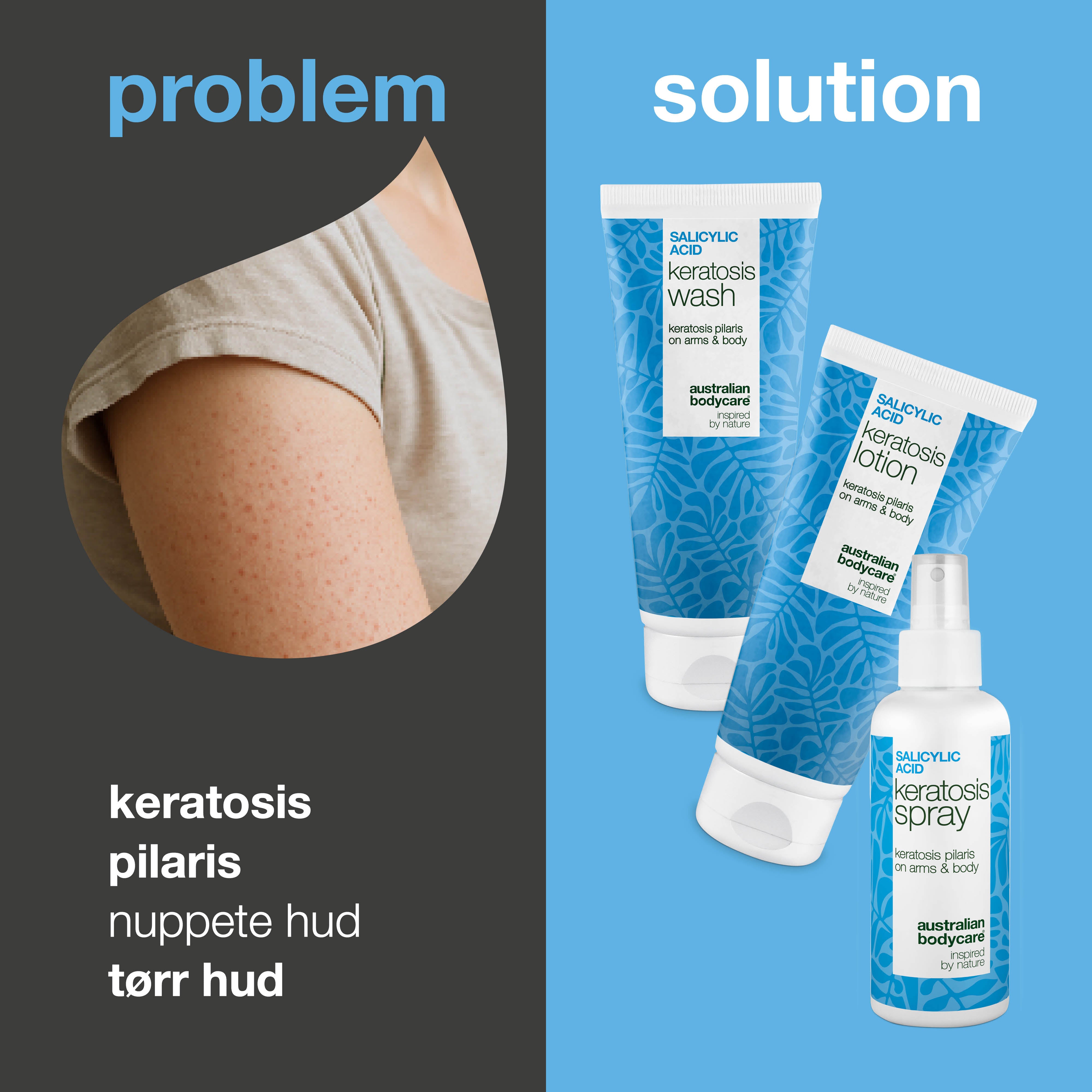 Pakke mot Keratosis Pilaris – Glatter ru, tørr og nuppete hud — Hudpleiesett for Keratosis Pilaris lindrer gåsehud og ru hud. Perfekt for små nupper og ujevn hudtekstur.