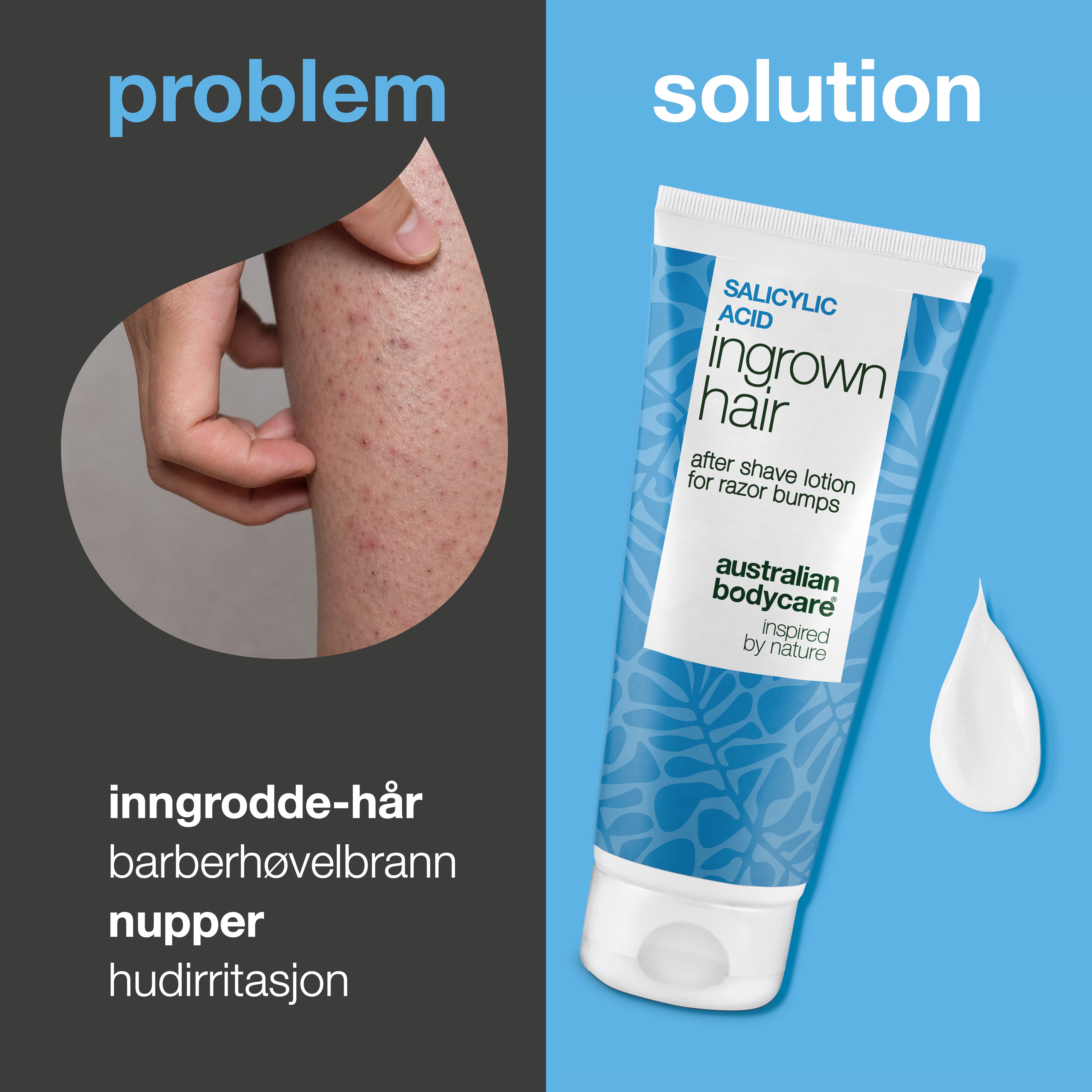 Salisylsyre After Shave Lotion mot inngrodde hår, røde nupper og irritasjon etter barbering. Produktet vises ved siden av hud med synlige røde nupper og inngrodde hår.