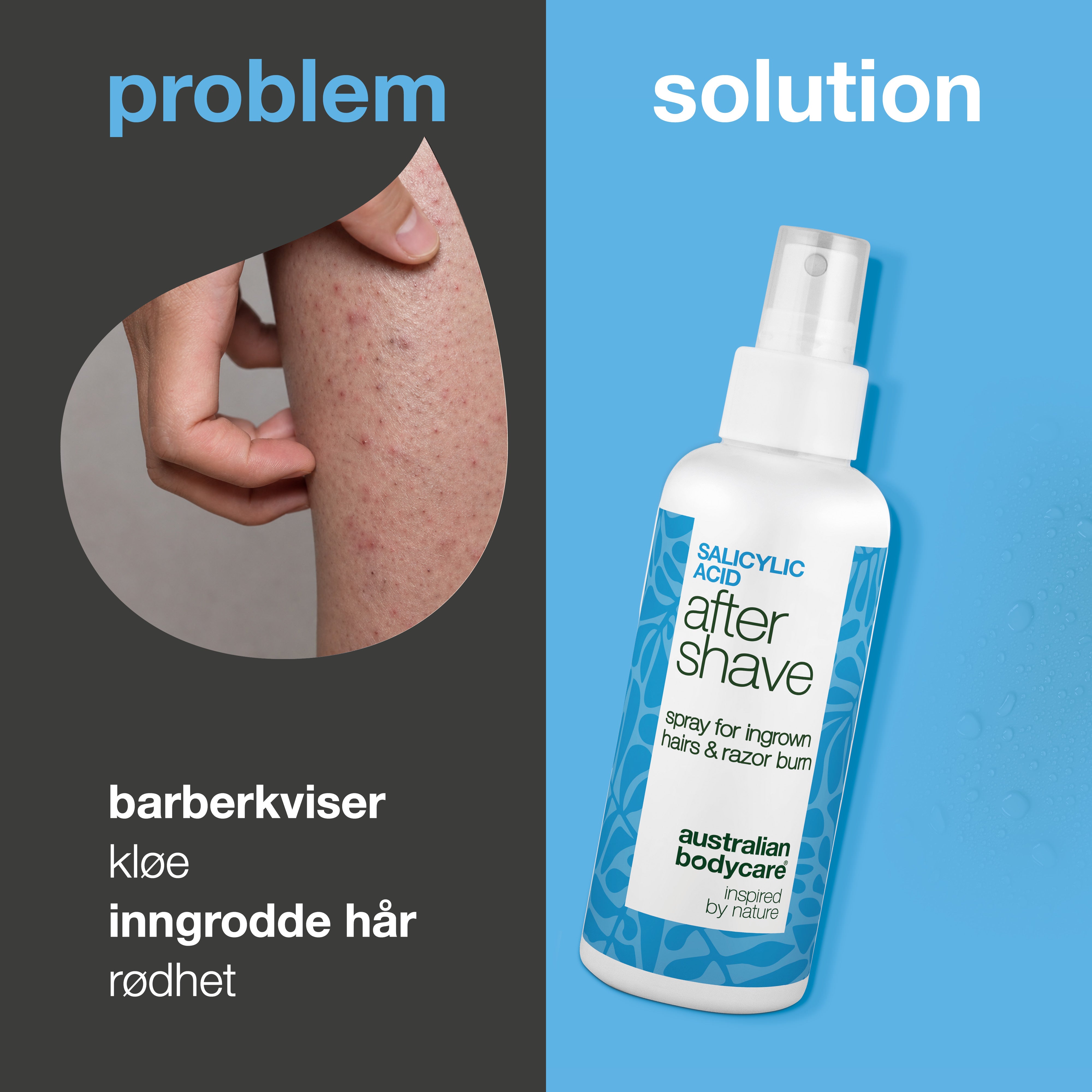 Salisylsyre After Shave Spray mot røde nupper — After Shave Spray mot inngrodde hår og røde nupper. Beroliger kløe med salisylsyre og Aloe Vera for et glatt resultat. Prøv den nå.