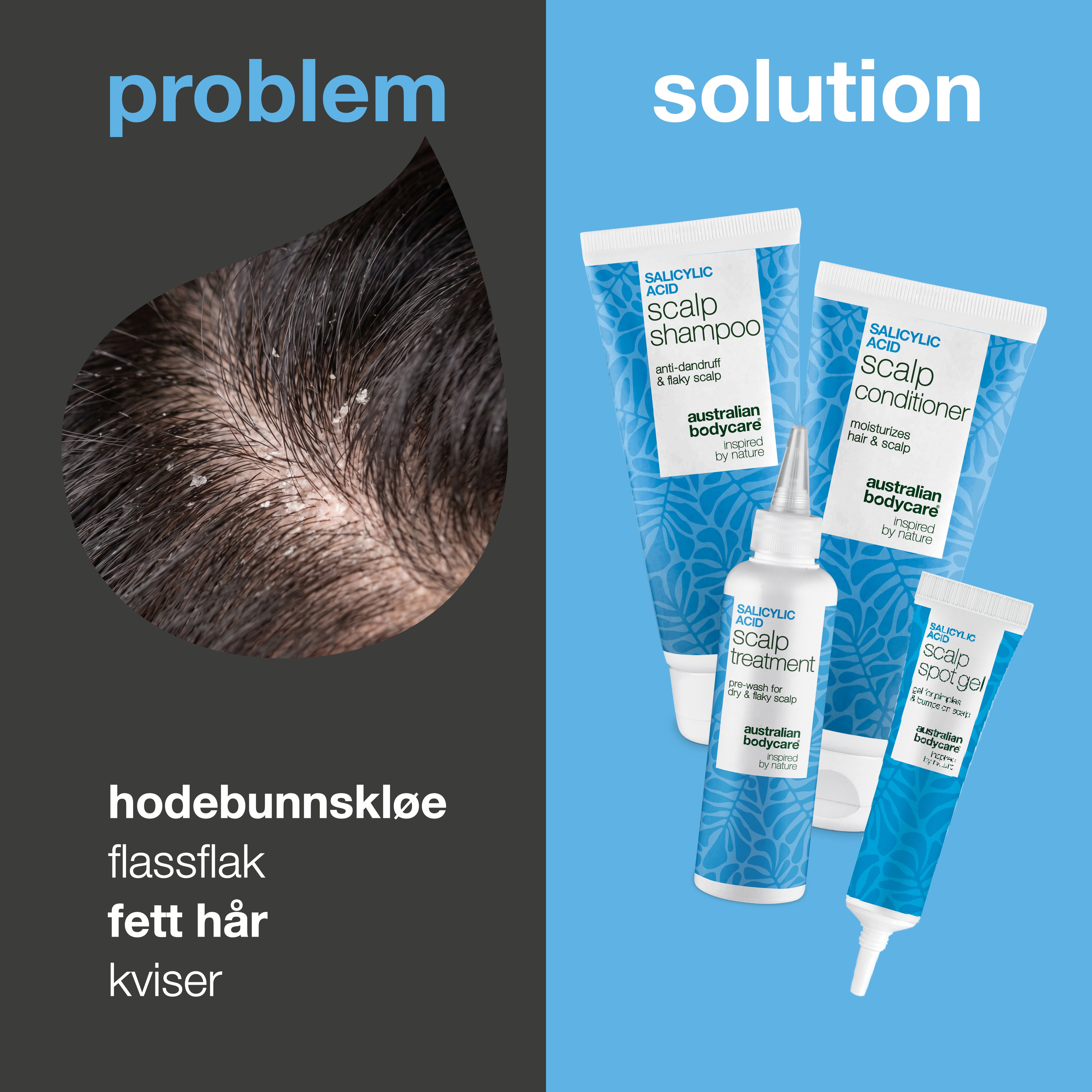 Problem og løsning: nærbilde av flass i hodebunnen ved siden av de fire produktene mot kløe, flass og kviser