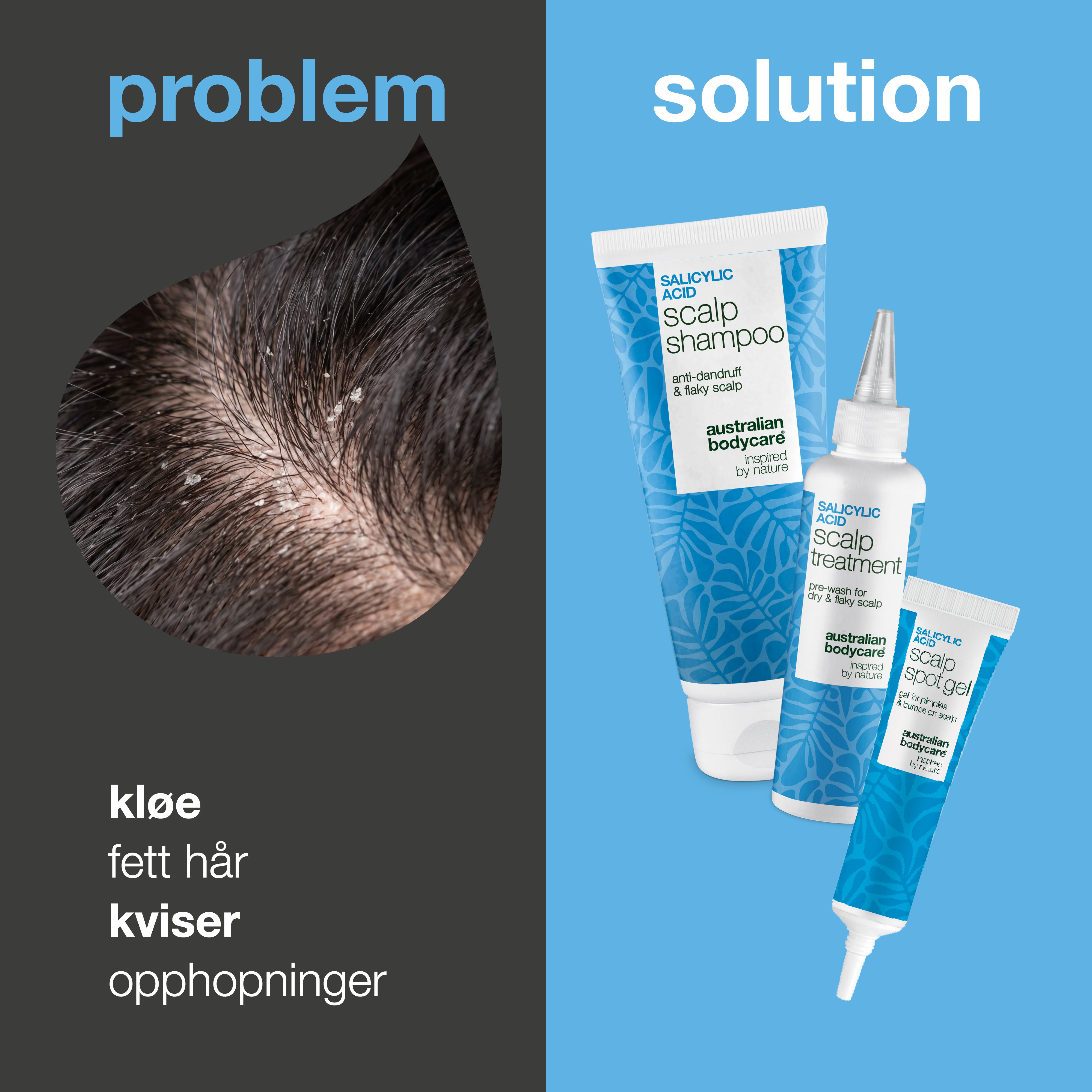 Problem og løsning: nærbilde av kløe, fett hår og opphopning i hodebunnen ved siden av settets tre produkter