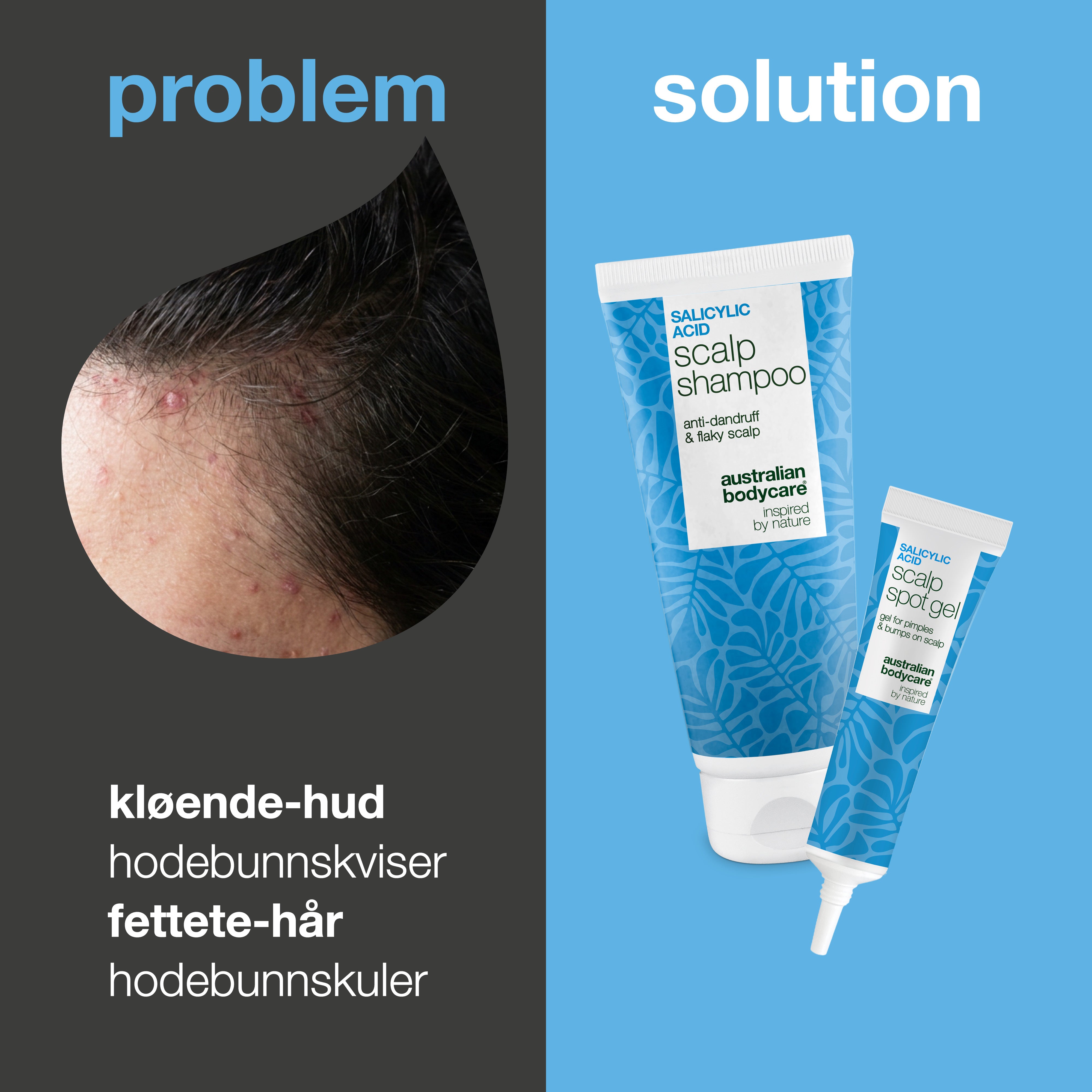 Problem og løsning: nærbilde av kviser og knopper i hodebunnen ved siden av settets sjampo og spot gel