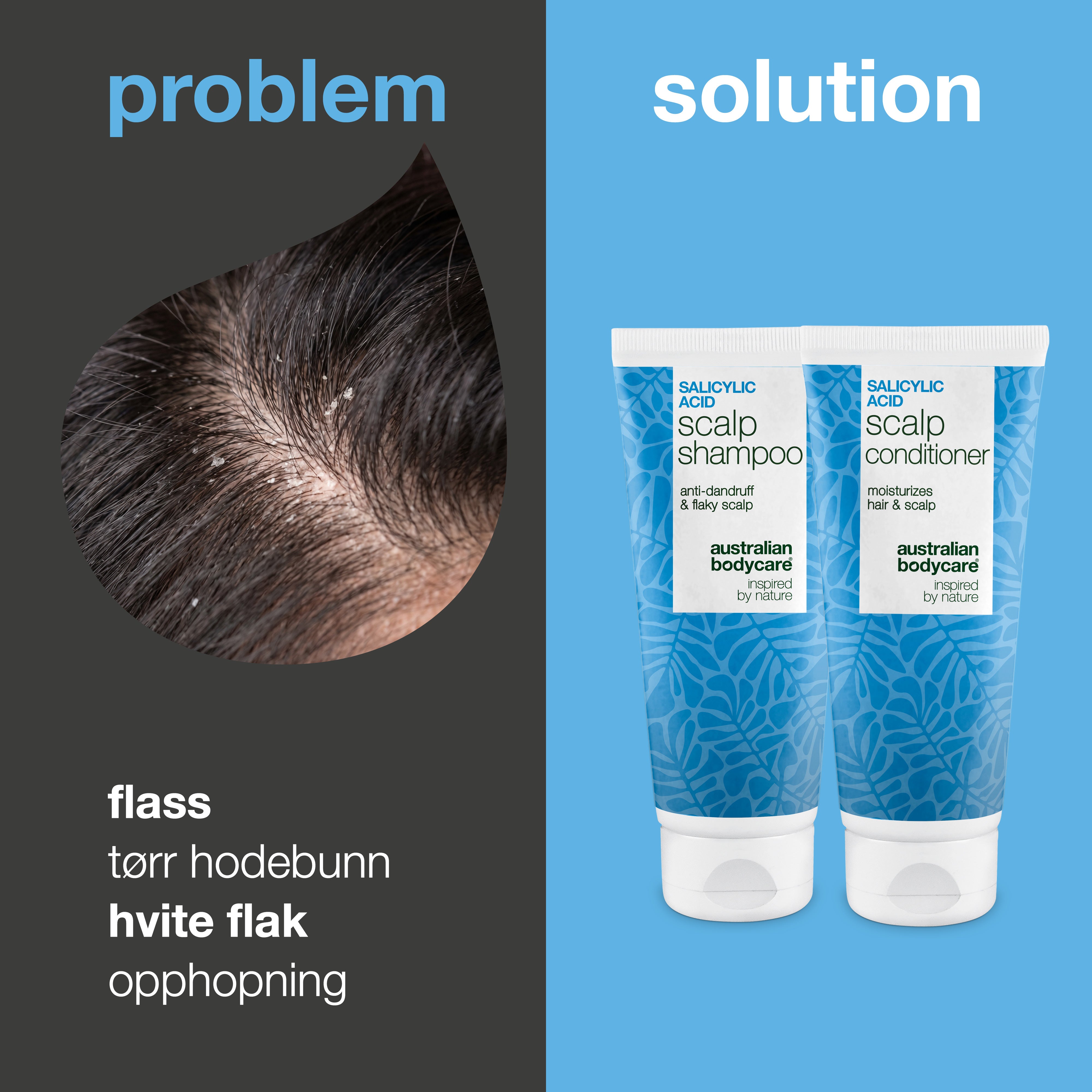 Problem og løsning: nærbilde av flass og hvite flak i hodebunnen ved siden av sjampo og balsam fra pakken