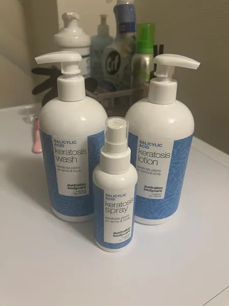 Kunderesultat keratosis pilaris – Isabell C.
