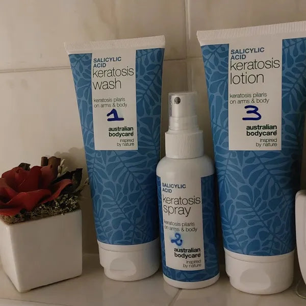Kunderesultat keratosis pilaris – Michela C.