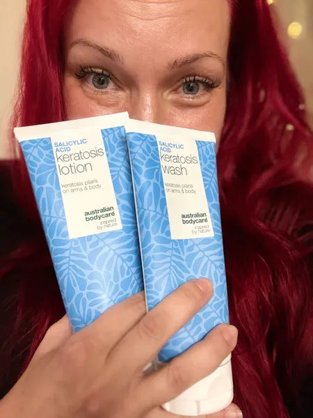 Kunderesultat keratosis pilaris – Viktorija K.