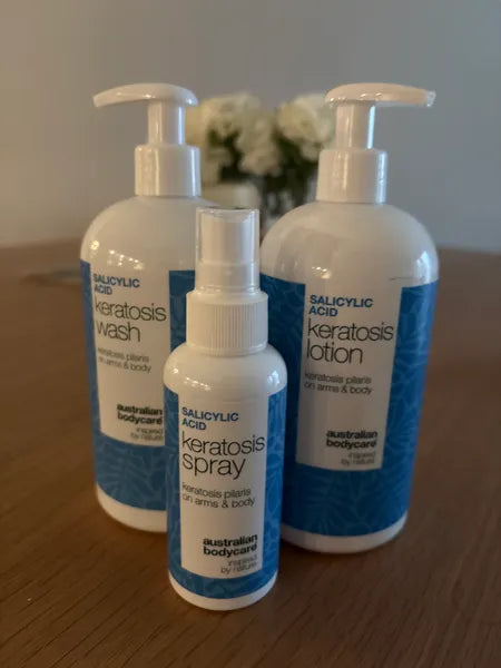 Kunderesultat keratosis pilaris – Walter P.