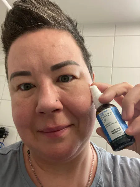 Kunderesultat kviser i ansiktet – Anne K.