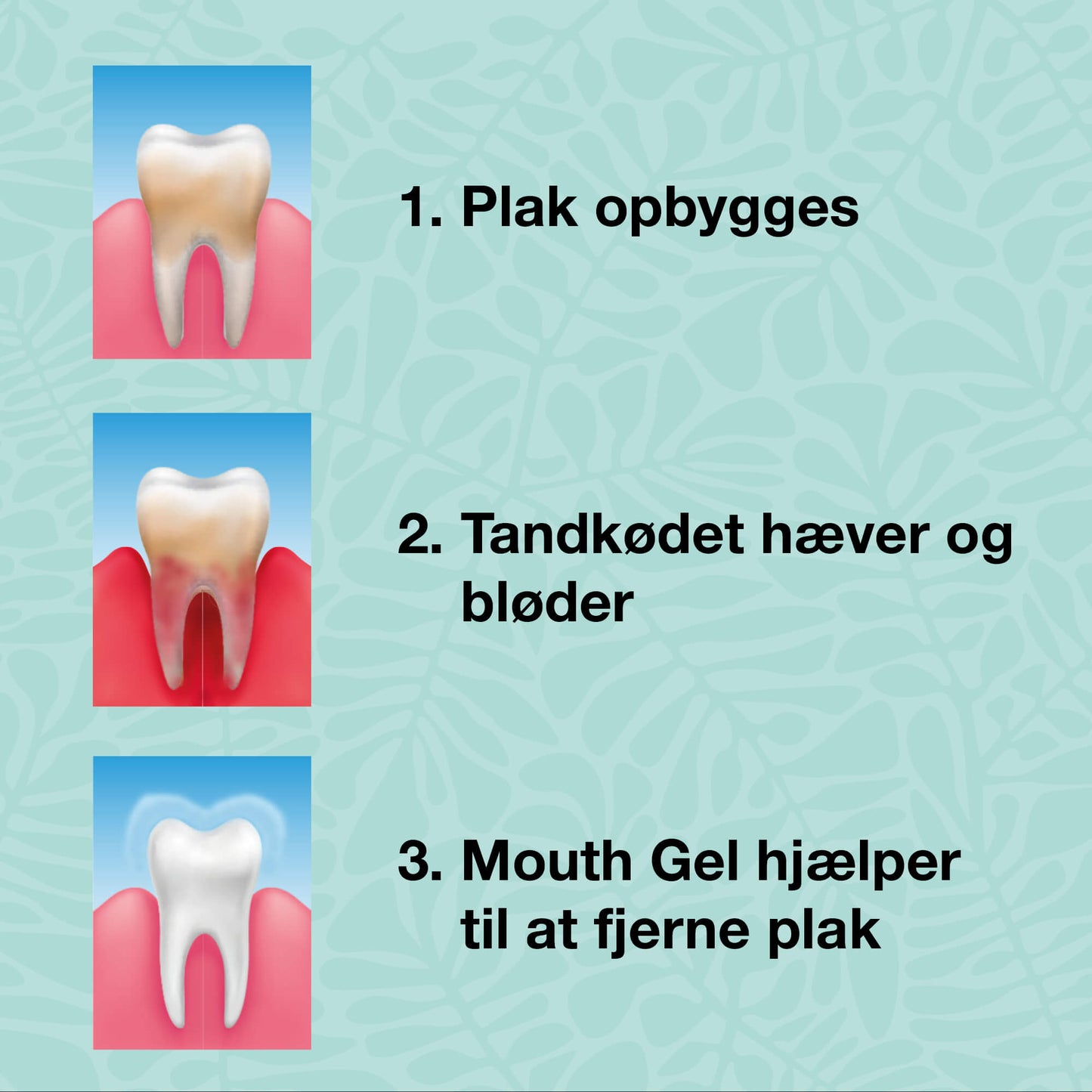 Start kit – 5 munnprodukter - Startpakke til god munnhygiene og pleie ved periodontitt og sopp