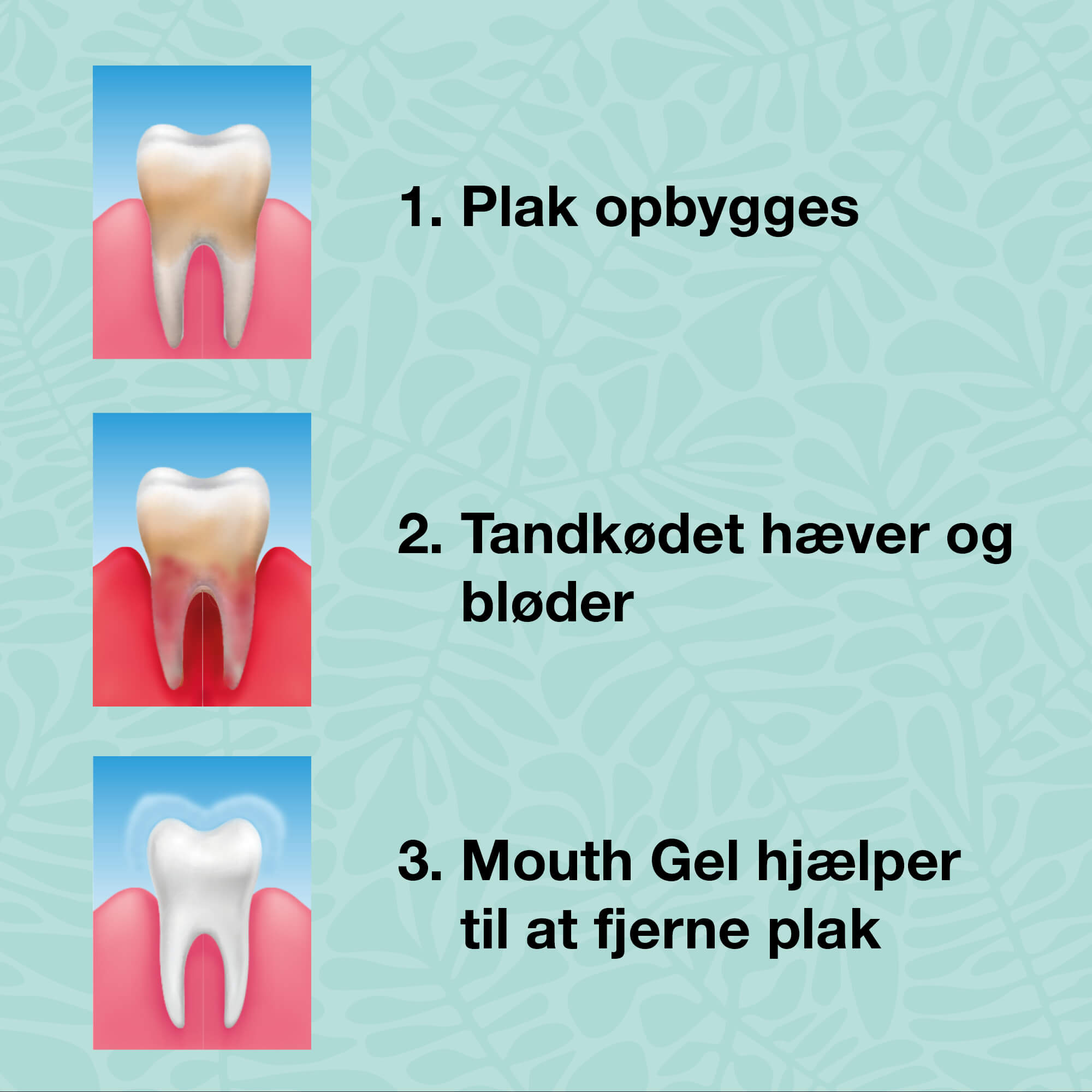 Start kit - 5 munnprodukter — Startpakke til god munnhygiene og pleie ved periodontitt og sopp