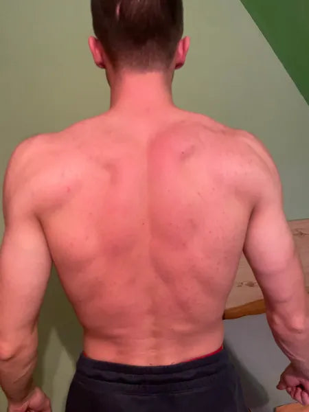 Kunderesultat kviser på kroppen – Marek D.